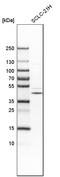 TRNA Methyltransferase 10C, Mitochondrial RNase P Subunit antibody, HPA036671, Atlas Antibodies, Western Blot image 