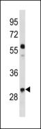 Cyclin D2 antibody, LS-C203893, Lifespan Biosciences, Western Blot image 