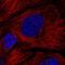 HPS4 Biogenesis Of Lysosomal Organelles Complex 3 Subunit 2 antibody, HPA050189, Atlas Antibodies, Immunocytochemistry image 