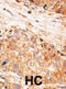 Baculoviral IAP Repeat Containing 7 antibody, abx032693, Abbexa, Immunohistochemistry frozen image 