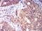 Killer cell immunoglobulin-like receptor 3DL1 antibody, NBP2-61687, Novus Biologicals, Immunohistochemistry frozen image 