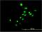 Nuclear receptor subfamily 4 group A member 3 antibody, H00008013-M02, Novus Biologicals, Immunofluorescence image 