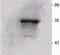 Ribosomal Protein S6 Kinase B2 antibody, TA326341, Origene, Immunoprecipitation image 