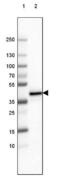 Fc Fragment Of IgG Receptor And Transporter antibody, NBP2-61627, Novus Biologicals, Immunohistochemistry paraffin image 