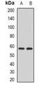 Protein Phosphatase 3 Catalytic Subunit Gamma antibody, orb381978, Biorbyt, Western Blot image 