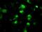 Protein Phosphatase Methylesterase 1 antibody, NBP2-02240, Novus Biologicals, Immunofluorescence image 