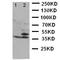 Branched Chain Amino Acid Transaminase 1 antibody, LS-C312695, Lifespan Biosciences, Western Blot image 