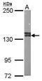 Valosin Containing Protein Interacting Protein 1 antibody, GTX107169, GeneTex, Western Blot image 