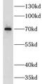 G Protein Signaling Modulator 2 antibody, FNab03618, FineTest, Western Blot image 