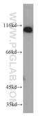 Phosphoinositide-3-Kinase Regulatory Subunit 3 antibody, 55036-1-AP, Proteintech Group, Western Blot image 