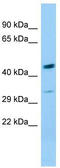 BKRB1 antibody, TA338374, Origene, Western Blot image 
