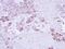 Epoxide Hydrolase 1 antibody, NBP1-33011, Novus Biologicals, Immunohistochemistry frozen image 