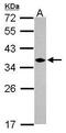 Chromosome 1 Open Reading Frame 74 antibody, PA5-31680, Invitrogen Antibodies, Western Blot image 
