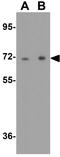 Praja Ring Finger Ubiquitin Ligase 1 antibody, GTX31608, GeneTex, Western Blot image 