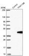 Family With Sequence Similarity 118 Member B antibody, NBP1-93958, Novus Biologicals, Western Blot image 
