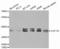 Eukaryotic Translation Elongation Factor 1 Delta antibody, STJ23477, St John