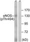 Nitric Oxide Synthase 3 antibody, AP55739PU-N, Origene, Western Blot image 