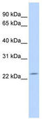 Deleted In Primary Ciliary Dyskinesia Homolog (Mouse) antibody, TA333819, Origene, Western Blot image 