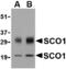 SCO Cytochrome C Oxidase Assembly Protein 1 antibody, MBS150654, MyBioSource, Western Blot image 