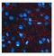 Beta-Secretase 1 antibody, NBP1-62416, Novus Biologicals, Immunofluorescence image 