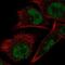 ElaC Ribonuclease Z 1 antibody, PA5-66844, Invitrogen Antibodies, Immunofluorescence image 