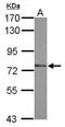 Zinc Finger X-Linked Duplicated A antibody, GTX121426, GeneTex, Western Blot image 