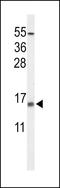 Potassium Voltage-Gated Channel Subfamily E Regulatory Subunit 5 antibody, LS-B12382, Lifespan Biosciences, Western Blot image 