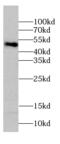 60S ribosomal protein L4 antibody, FNab07293, FineTest, Western Blot image 