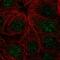 Zinc Finger Protein 425 antibody, HPA020087, Atlas Antibodies, Immunocytochemistry image 