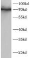 Interleukin 1 Receptor Associated Kinase 1 antibody, FNab10246, FineTest, Western Blot image 