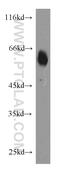 Calcium/Calmodulin Dependent Protein Kinase II Gamma antibody, 55140-1-AP, Proteintech Group, Western Blot image 
