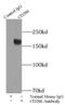 Mannose Receptor C-Type 1 antibody, FNab09812, FineTest, Immunoprecipitation image 