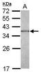 Capping Actin Protein Of Muscle Z-Line Subunit Alpha 1 antibody, PA5-31026, Invitrogen Antibodies, Western Blot image 