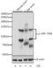 Amyloid Beta Precursor Protein antibody, AP0006, ABclonal Technology, Western Blot image 