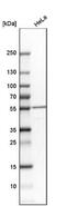 Mitochondrially Encoded NADH:Ubiquinone Oxidoreductase Core Subunit 4 antibody, NBP2-47365, Novus Biologicals, Western Blot image 
