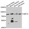 Meprin A Subunit Alpha antibody, A8133, ABclonal Technology, Western Blot image 
