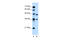 MID1 antibody, 31-346, ProSci, Enzyme Linked Immunosorbent Assay image 