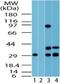 Fuzzy Planar Cell Polarity Protein antibody, NBP2-24750, Novus Biologicals, Western Blot image 