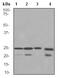 Lysophospholipase 1 antibody, ab91606, Abcam, Western Blot image 