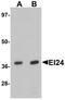 Etoposide-induced protein 2.4 antibody, PA5-72705, Invitrogen Antibodies, Western Blot image 
