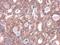 Microtubule Associated Protein 1 Light Chain 3 Beta antibody, GTX100240, GeneTex, Immunohistochemistry paraffin image 