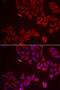 Galectin 8 antibody, 22-376, ProSci, Immunofluorescence image 