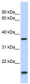 Zic Family Member 4 antibody, TA345434, Origene, Western Blot image 