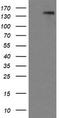 Platelet Derived Growth Factor Receptor Beta antibody, CF506226, Origene, Western Blot image 