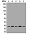 Jumonji Domain Containing 8 antibody, LS-C668933, Lifespan Biosciences, Western Blot image 