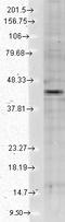 Potassium Voltage-Gated Channel Subfamily J Member 12 antibody, LS-C227618, Lifespan Biosciences, Western Blot image 
