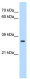 Developing Brain Homeobox 2 antibody, TA342392, Origene, Western Blot image 