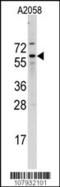 Cell Division Cycle 25B antibody, 62-766, ProSci, Western Blot image 
