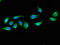 Docking protein 3 antibody, CSB-PA007019LA01HU, Cusabio, Immunofluorescence image 