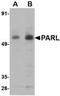 Presenilin Associated Rhomboid Like antibody, TA306629, Origene, Western Blot image 